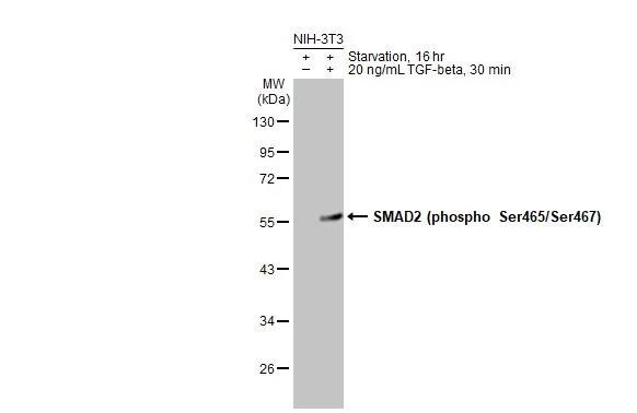 Smad2 [p Ser465, p Ser467] Antibody