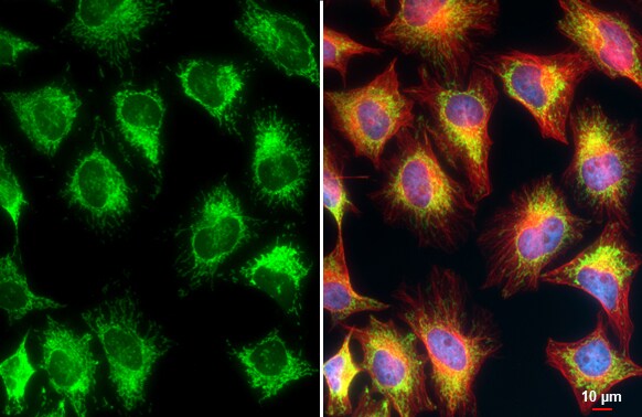 TOMM20 Antibody