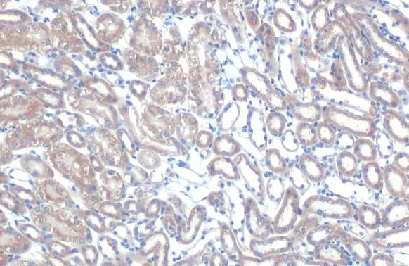 TOMM20 Antibody
