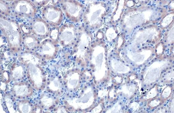 TOMM20 Antibody