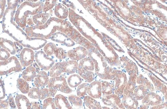 TOMM20 Antibody