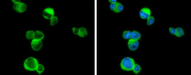 Phospholipase C beta 2 Antibody - BSA Free