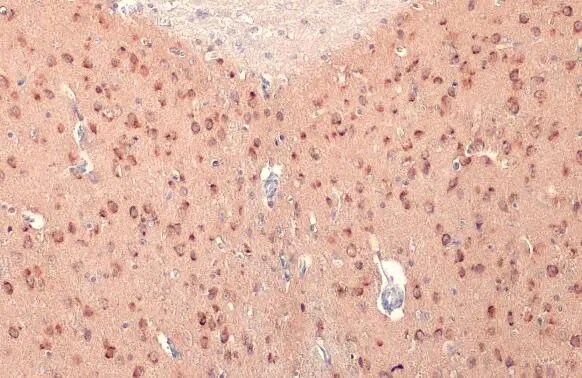 RASGRF1 Antibody
