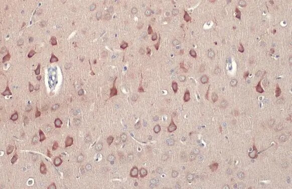 RASGRF1 Antibody