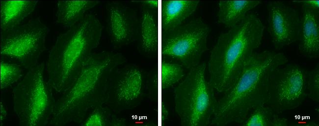 PKC mu Antibody - BSA Free