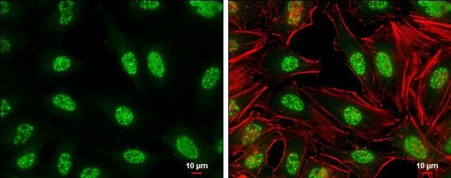 c-jun [p Ser73] Antibody