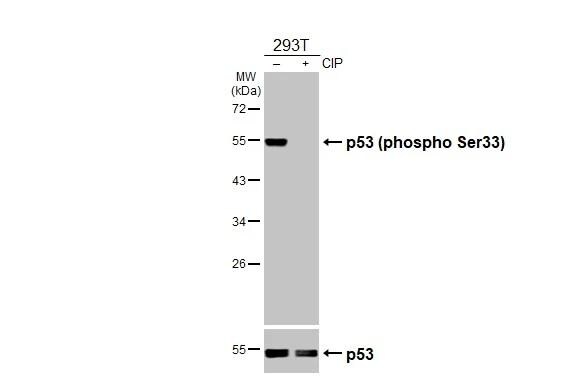 p53 [p Ser33] Antibody