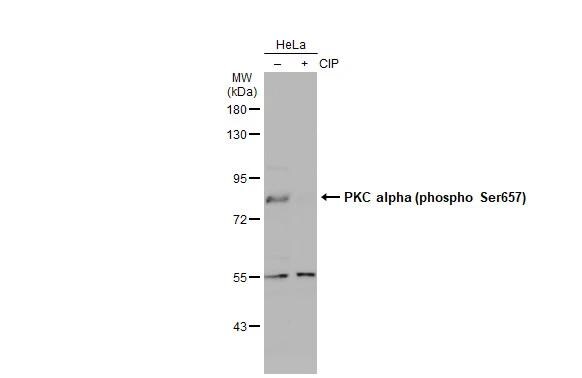 PKC alpha [p Ser657] Antibody