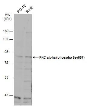PKC alpha [p Ser657] Antibody