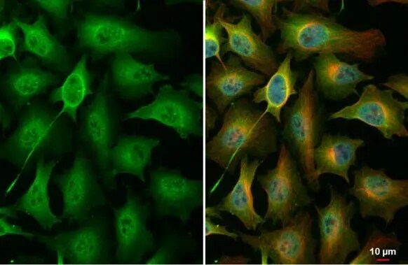 PKC zeta [p Thr410] Antibody