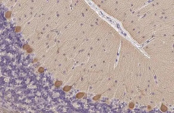 PKC zeta [p Thr410] Antibody