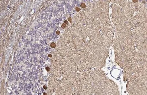 PKC zeta [p Thr410] Antibody