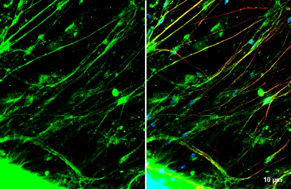 CGRP1 Antibody - BSA Free