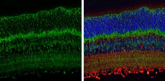 EAAT2/GLT1 Antibody - BSA Free