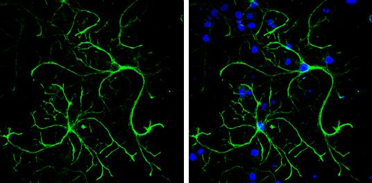 alpha Desmuslin Antibody