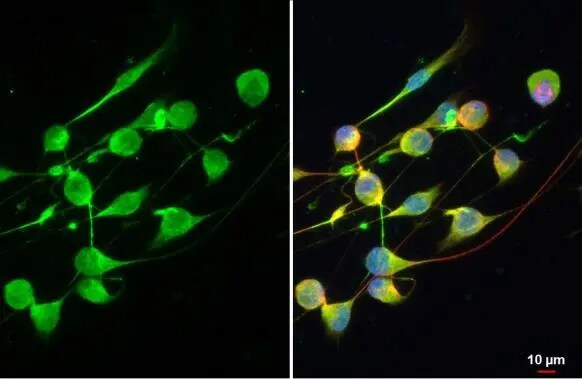 ANKRD16 Antibody