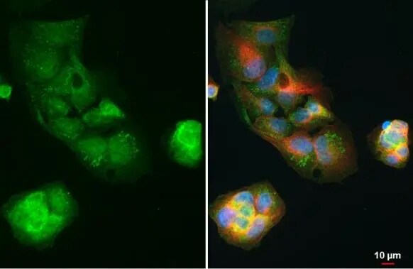 Apolipoprotein E/ApoE Antibody - R136S Mutant