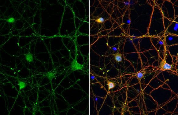 Tau [p Thr217] Antibody