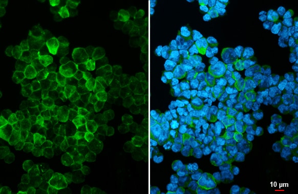 HLA DQA1 Antibody