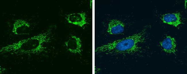 Glutaminase Antibody (GT1075) - Azide and BSA Free