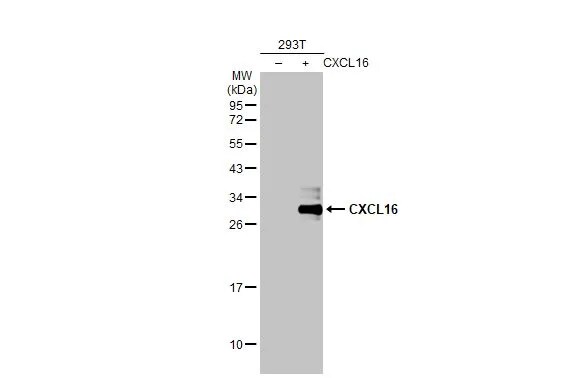 CXCL16 Antibody (GT516)
