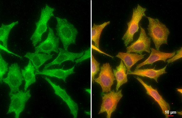 CXCL16 Antibody (GT516)