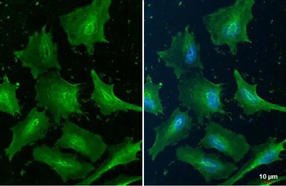 Cofilin Antibody (GT217)