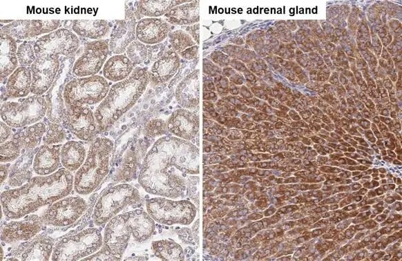 SDHA Antibody (GT20710)