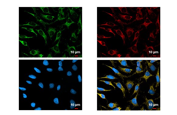 SDHA Antibody (GT20710)