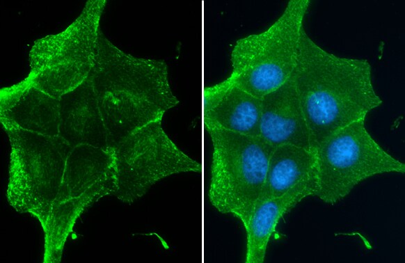 beta-Catenin Antibody (GT2169)