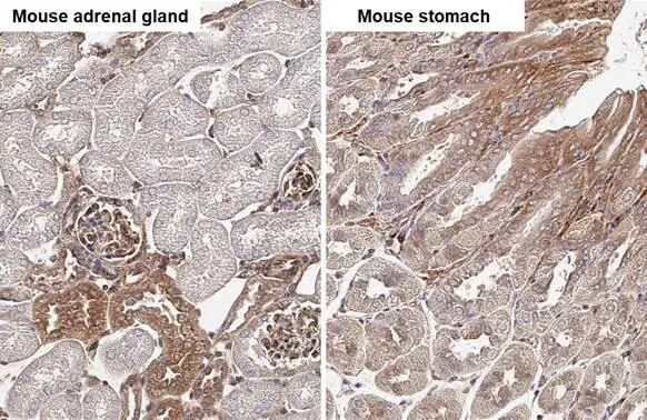 non-muscle Myosin IIA Antibody (GT218)