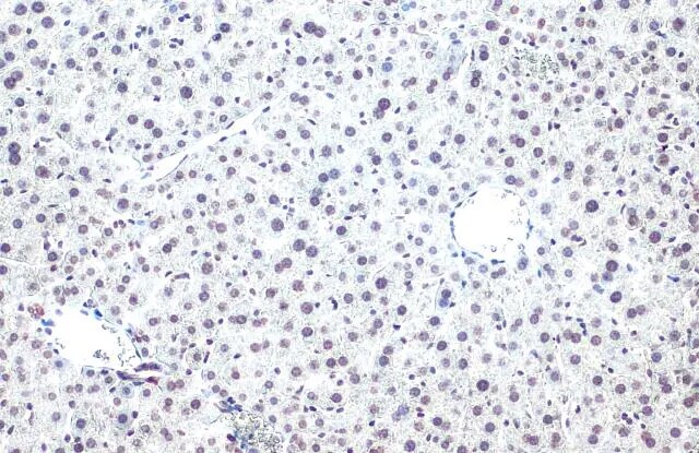 Histone H2B [ac Lys20] Antibody (GT578)