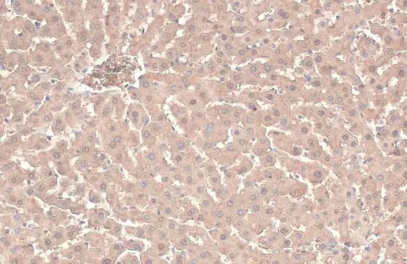 ATP6V1A Antibody (GT811)