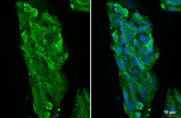 ATP6V1A Antibody (GT811) - Azide and BSA Free
