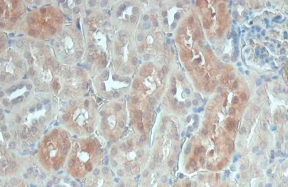 PSAT1 Antibody (GT1353)
