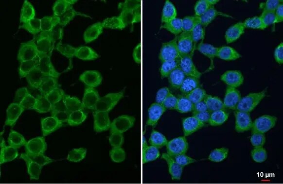 PSAT1 Antibody (GT1353)