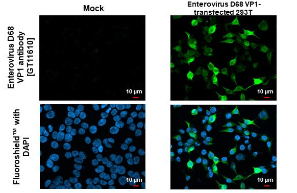 Enterovirus D68 VP1 Antibody (GT11610) - Azide and BSA Free