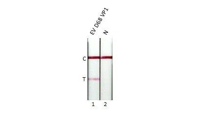 Enterovirus D68 VP1 Antibody (GT1843)