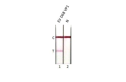 Enterovirus D68 VP1 Antibody (GT1843)