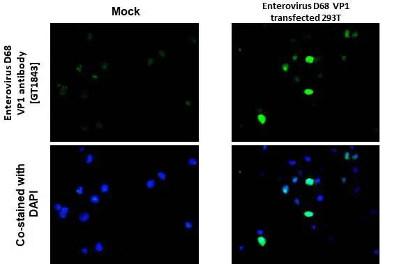 Enterovirus D68 VP1 Antibody (GT1843) - Azide and BSA Free