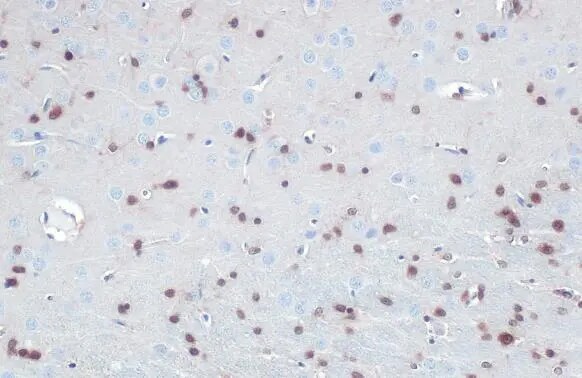 QKI/Quaking Antibody (GT2612)