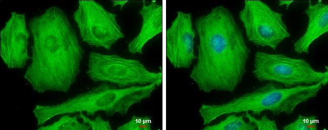 non-muscle Myosin IIA [p Ser1943] Antibody (GT144) - Azide and BSA Free