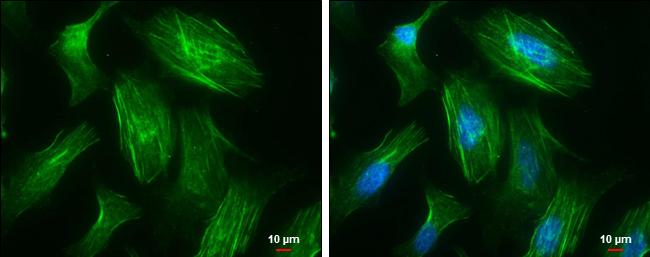 non-muscle heavy chain 10 Myosin Antibody (GT246) - Azide and BSA Free
