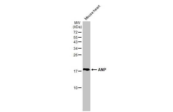 Atrial Natriuretic Peptide/ANP Antibody (GT1068)