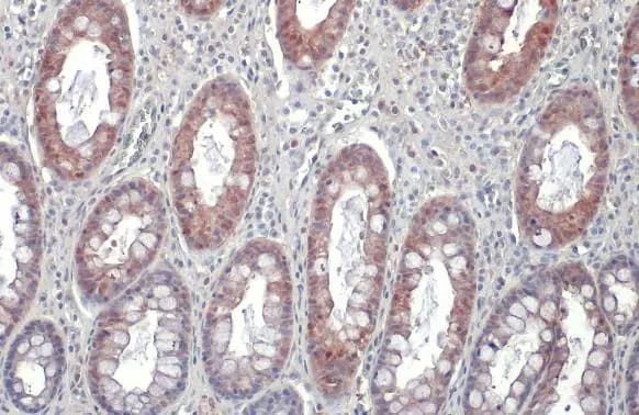 Galectin-3 Antibody (GT12712)