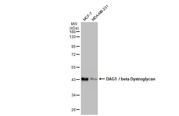 Beta Dystroglycan Antibody (GT9112) - Azide and BSA Free