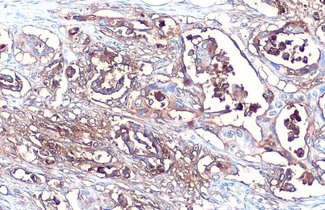 CA19-9/Sialyl Lewis A Antibody (GT252)