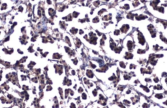 ATM Antibody (2C1-RB)