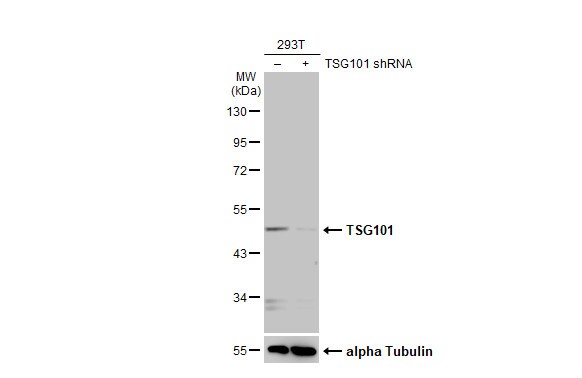 TSG101 Antibody (4A10-RB)