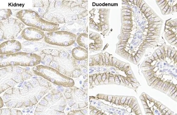 Sodium Potassium ATPase Alpha 1 Antibody (HL114)